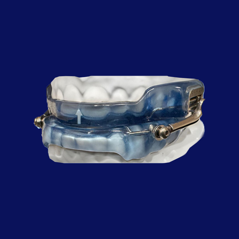 The image shows a blue dental retainer with a metal clasping mechanism.